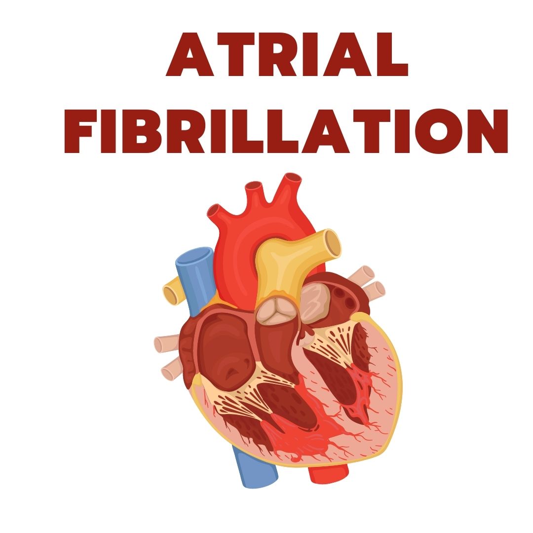Atrial Fibrillation (A-Fib)