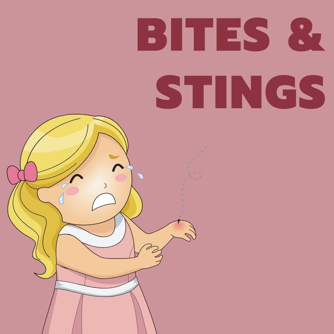 Bites & Stings