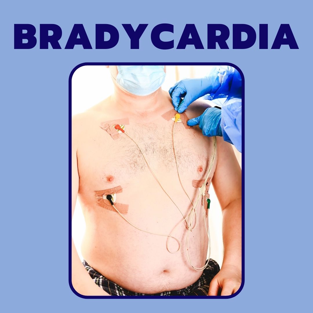 Bradycardia