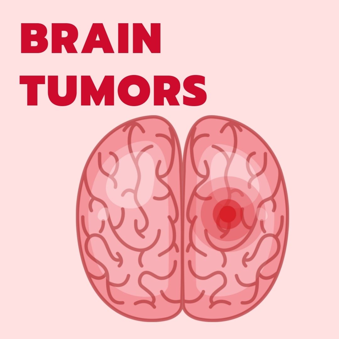 Brain Tumors