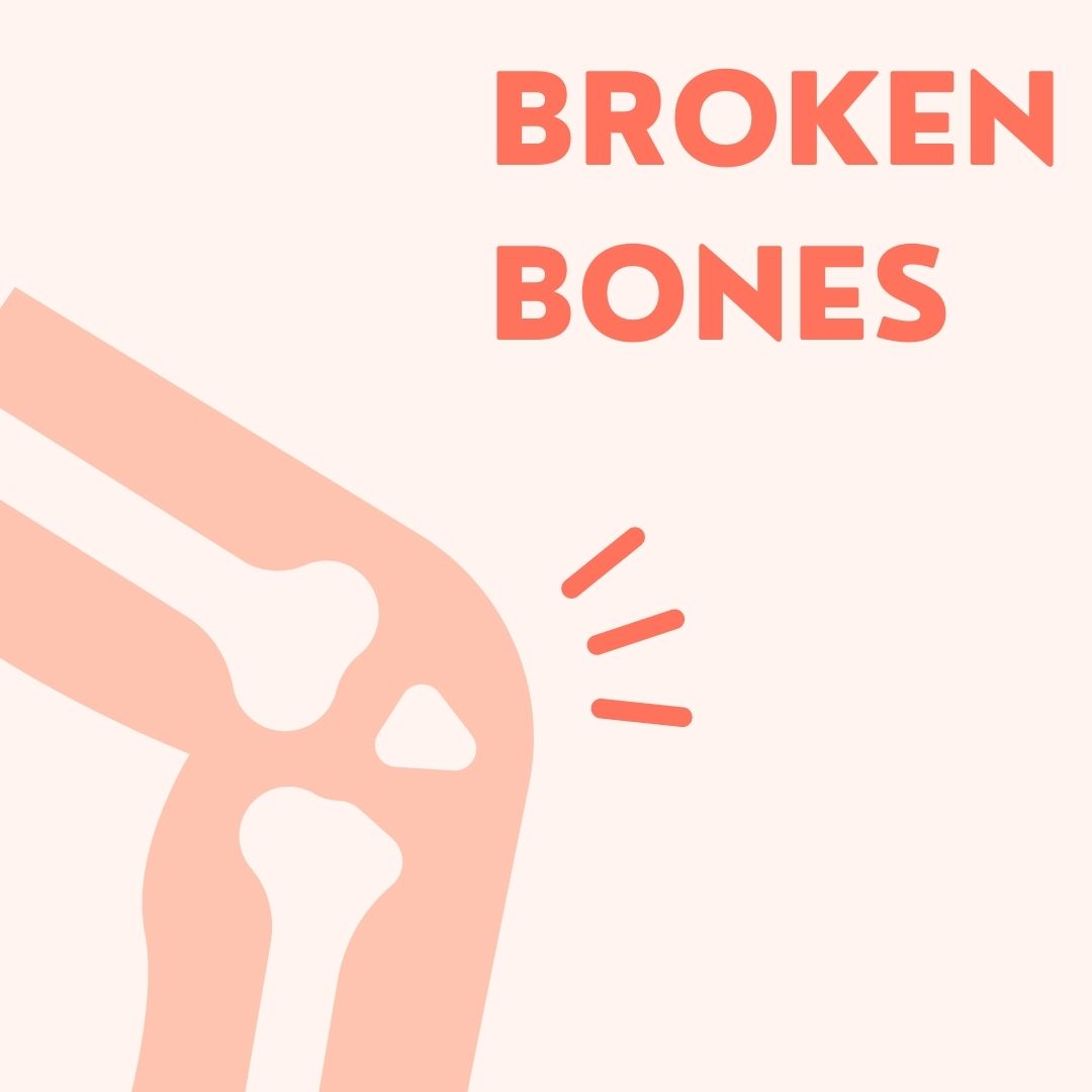 Broken Bones