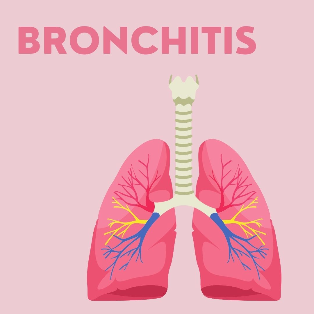 Bronchitis