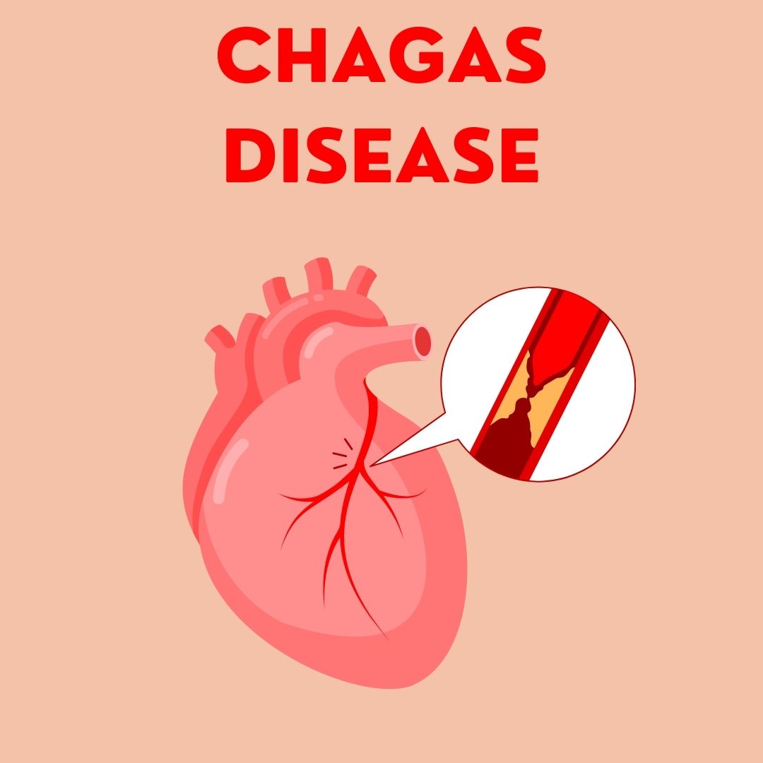 Chagas Disease