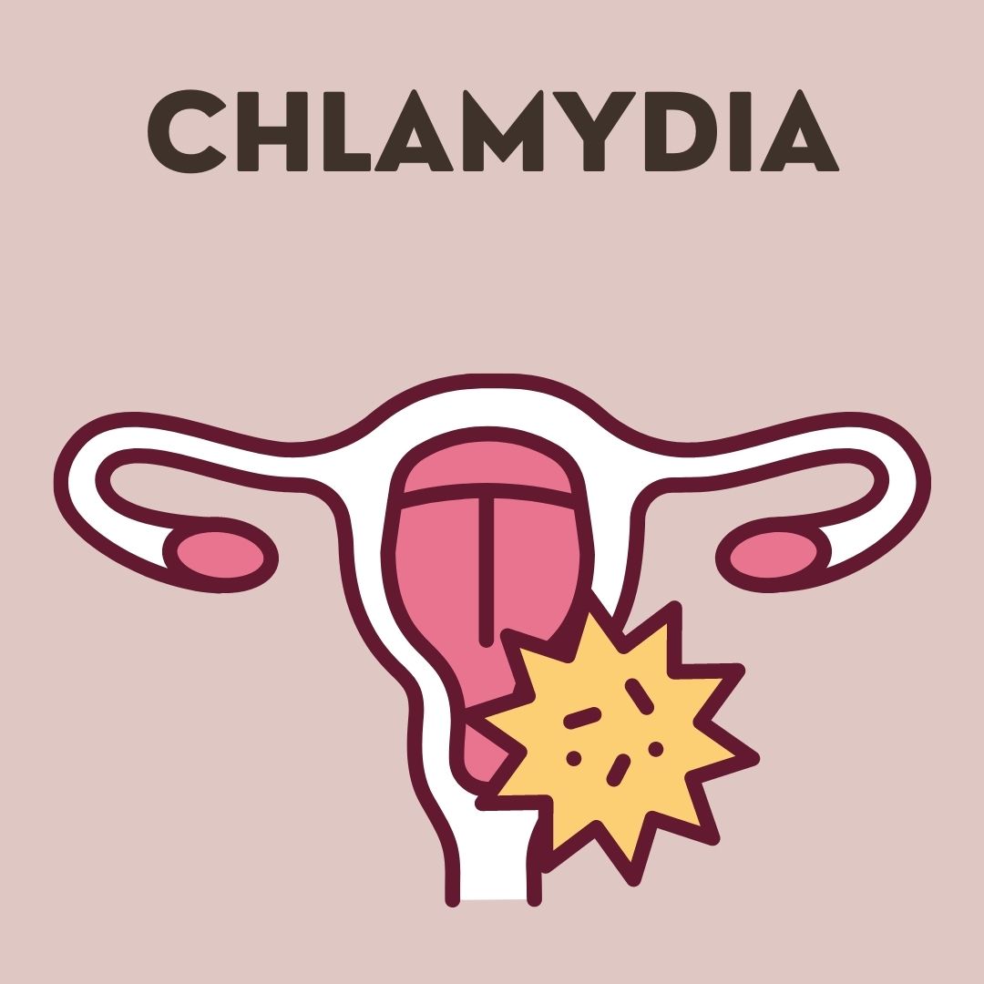 Chlamydia