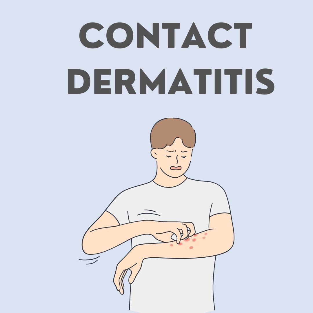 Contact Dermatitis