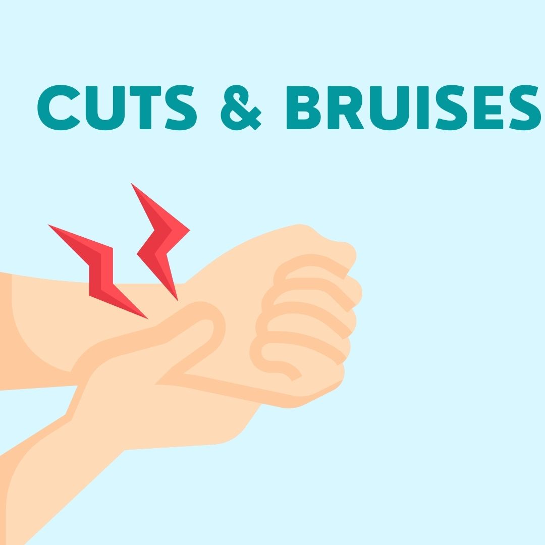 Cuts & Bruises