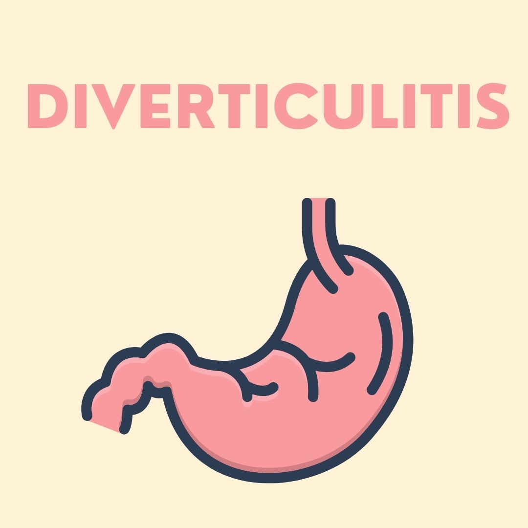 Diverticulitis