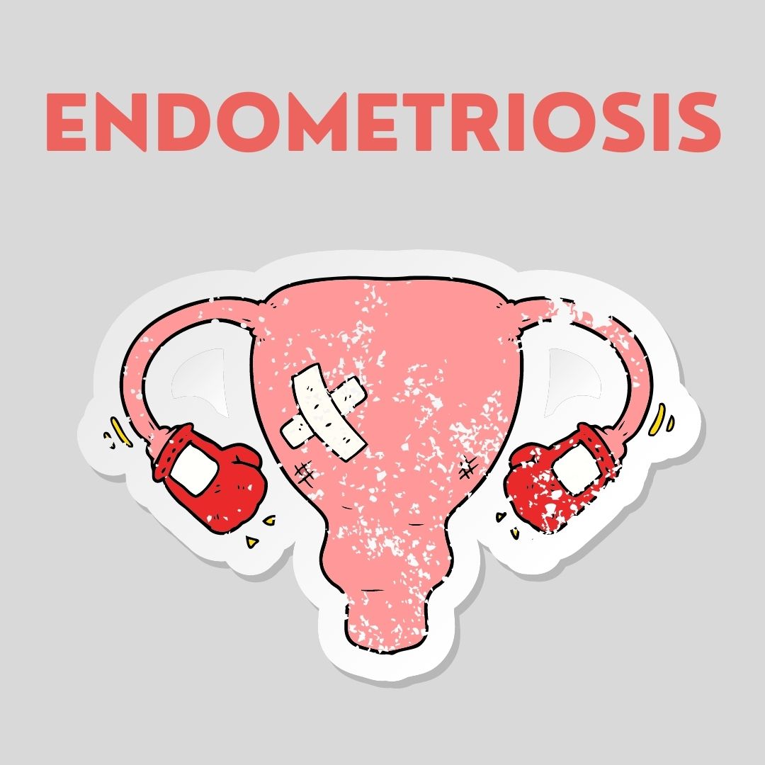 Endometriosis