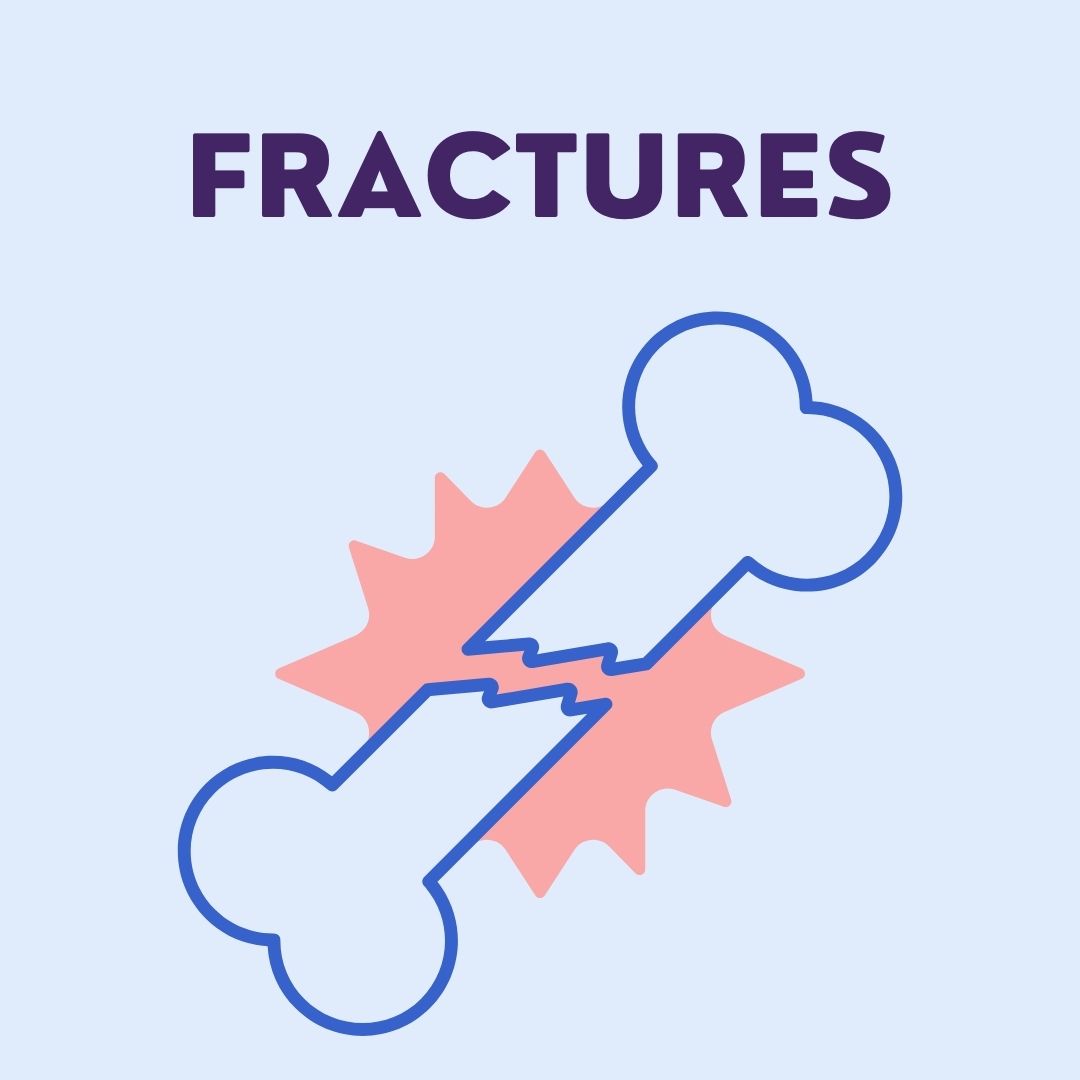 Fractures