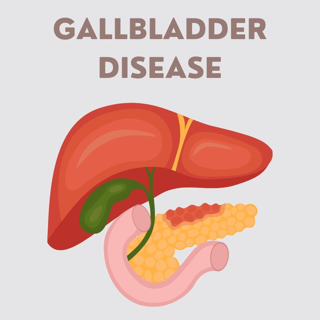 Gallbladder Disease