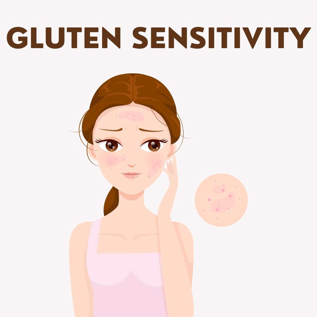 Gluten Sensitivity