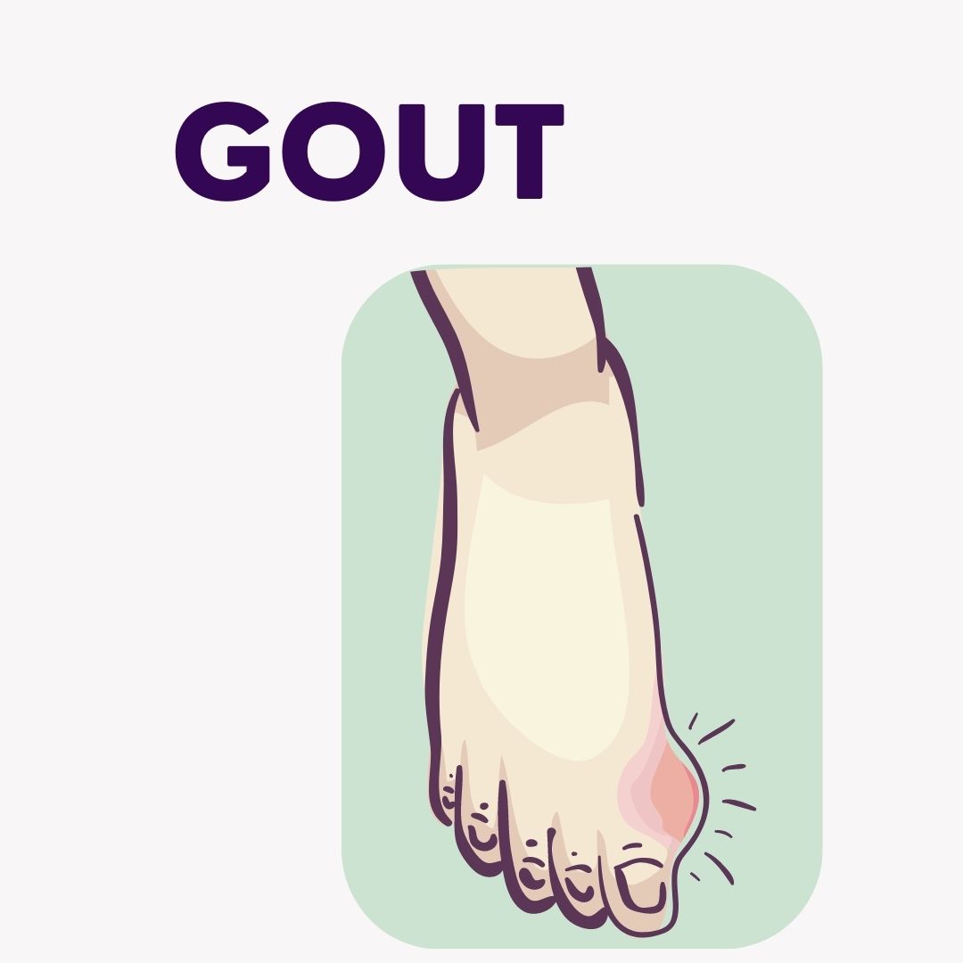 Gout