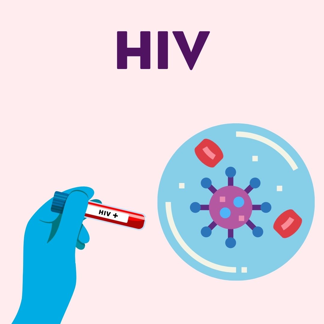 HIV