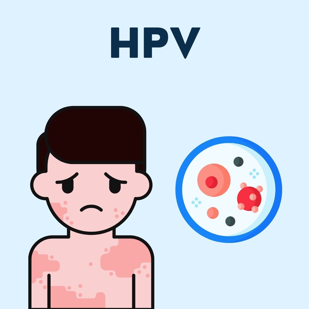 HPV