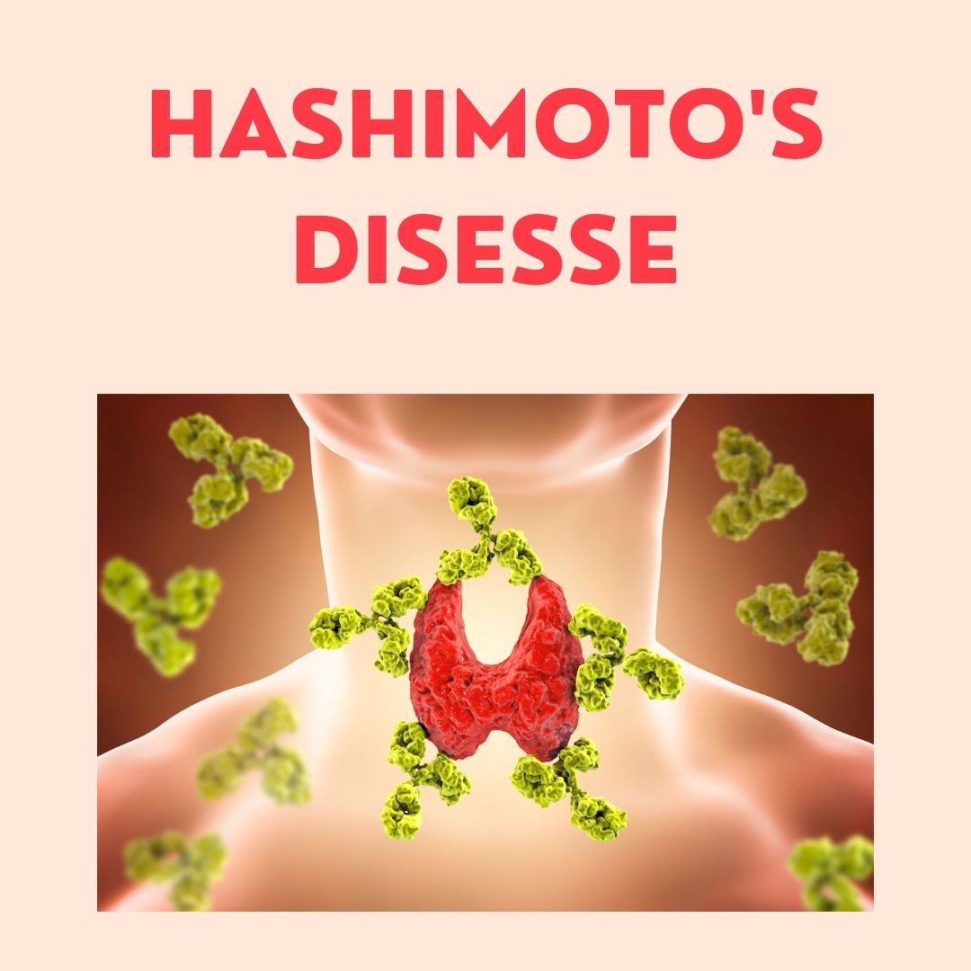 Hashimoto's Disease