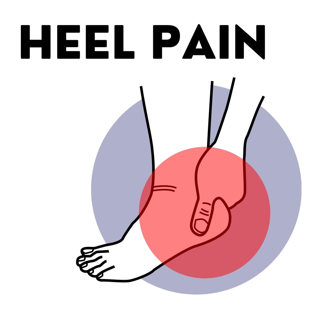 Heel Pain