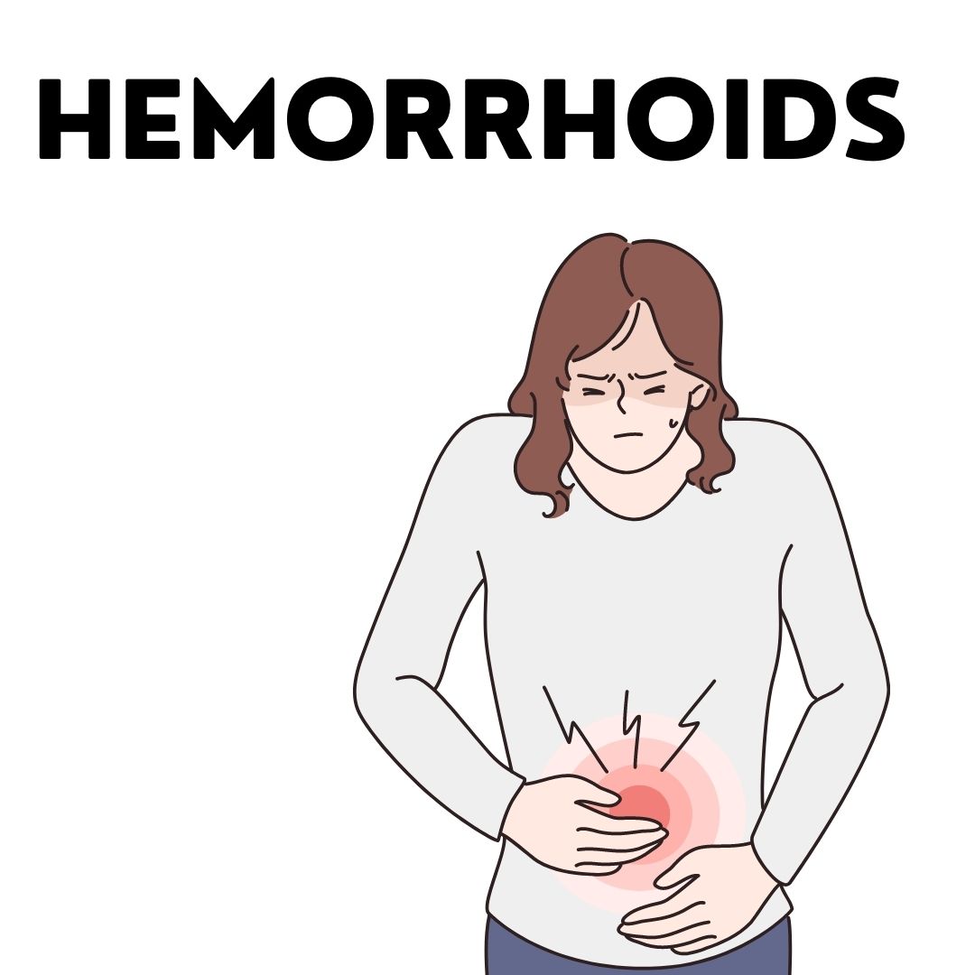 Hemorrhoids