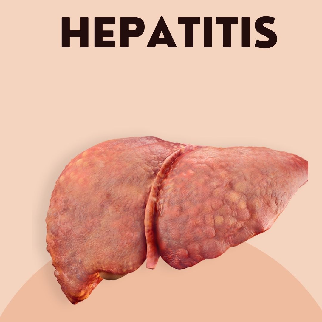 Hepatitis