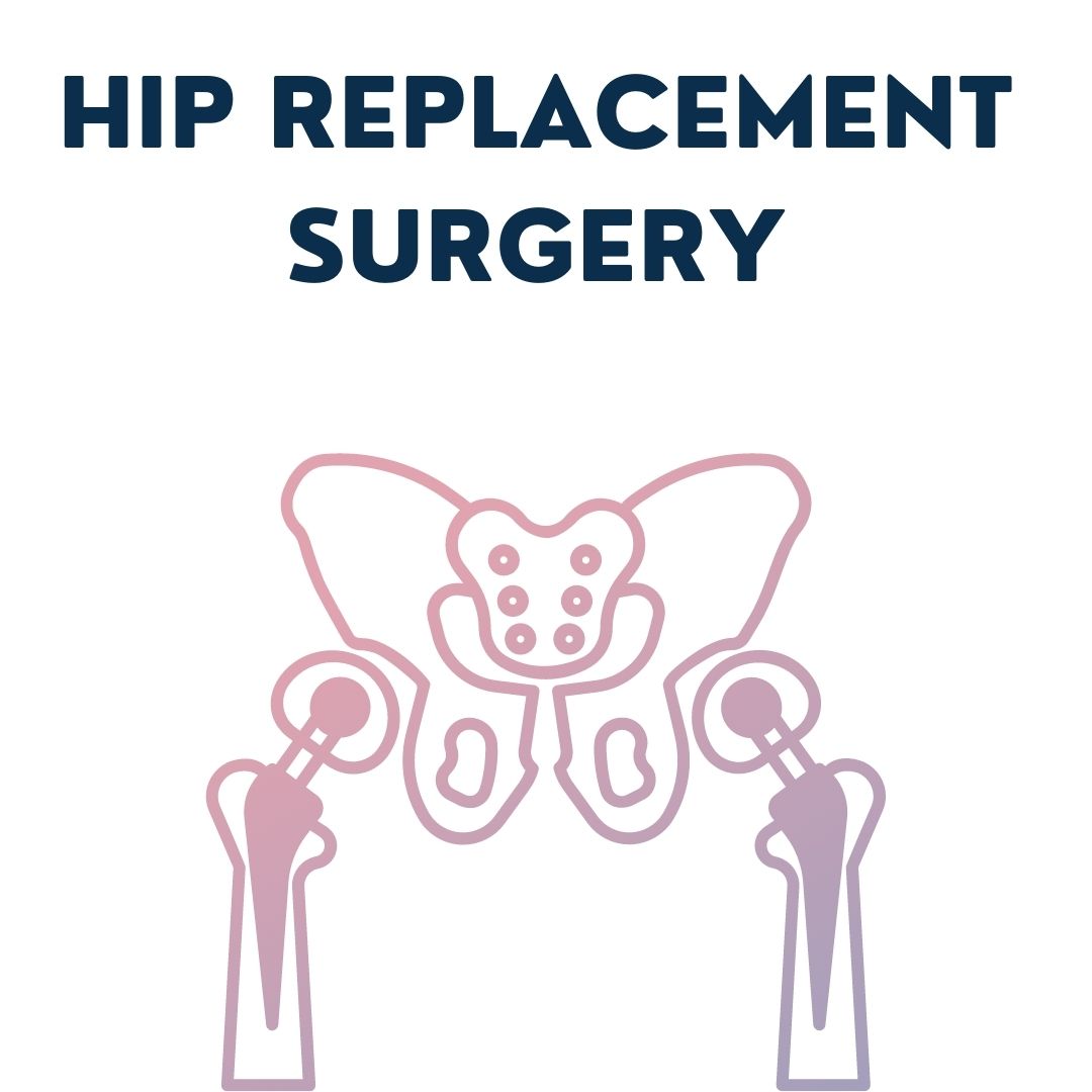 Hip Replacement Surgery