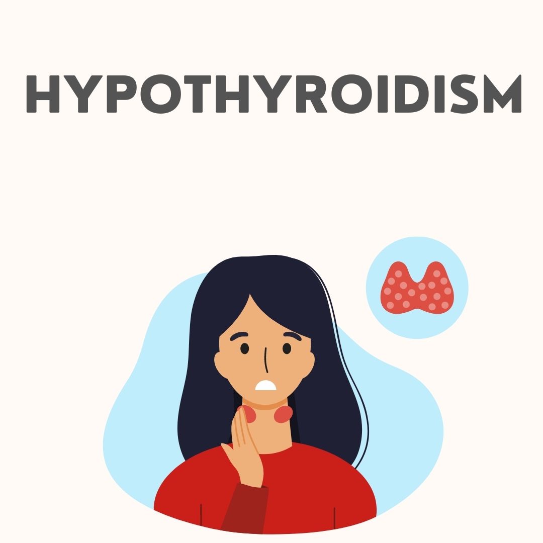 Hyperthyroidism