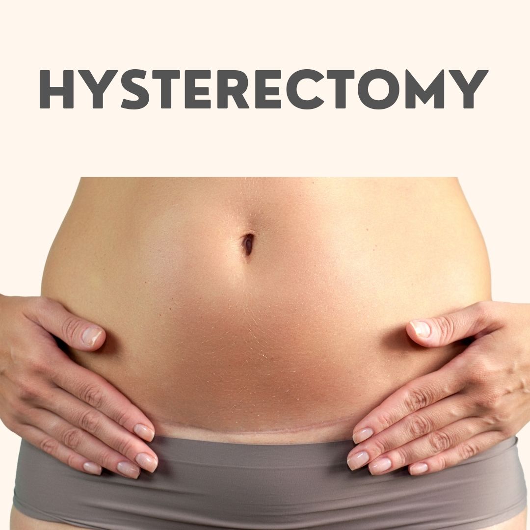 Hysterectomy