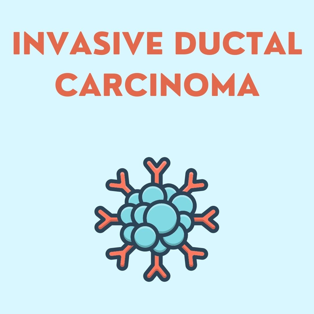 Invasive Ductal Carcinoma