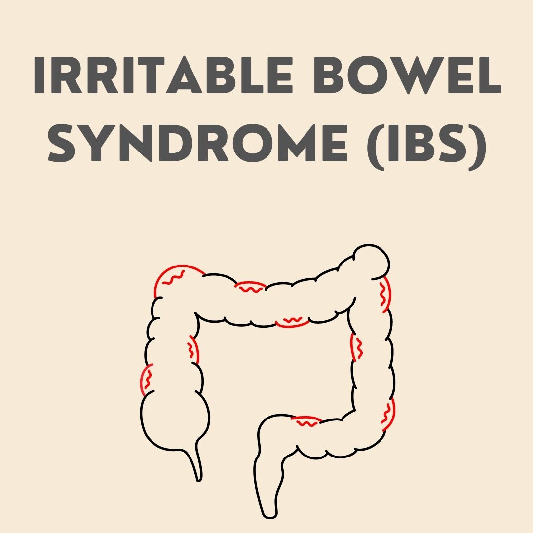 Irritable Bowel Syndrome (IBS)