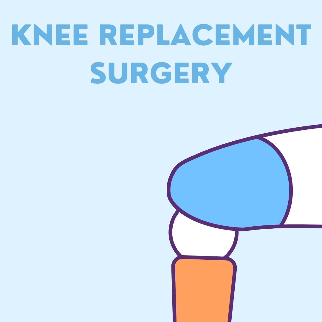 Knee Replacement Surgery