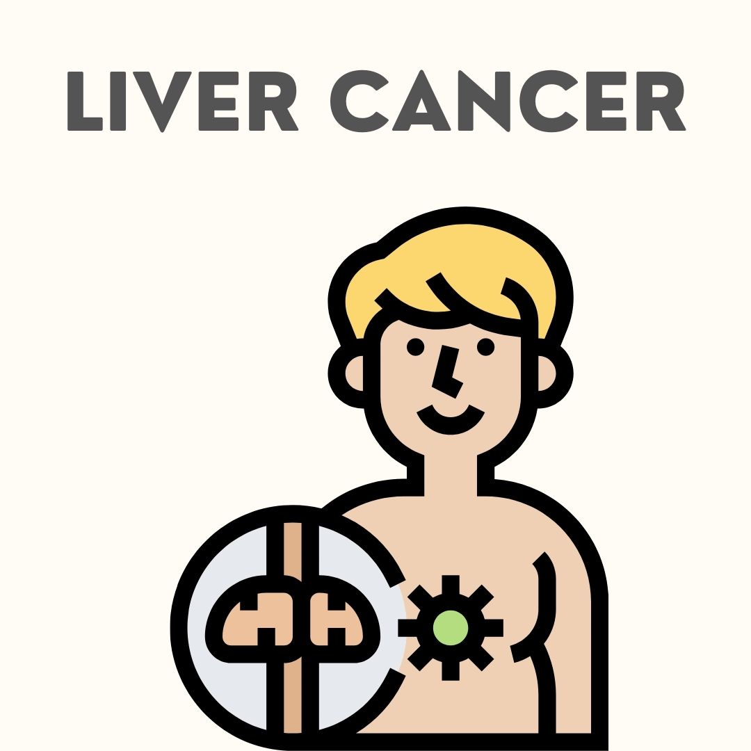 Liver Cancer