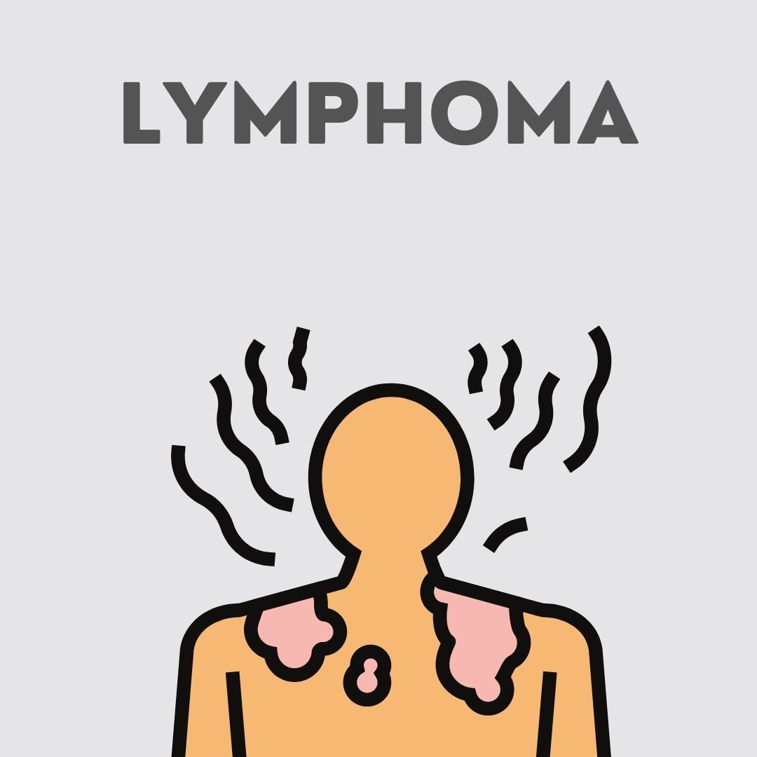 Lymphoma