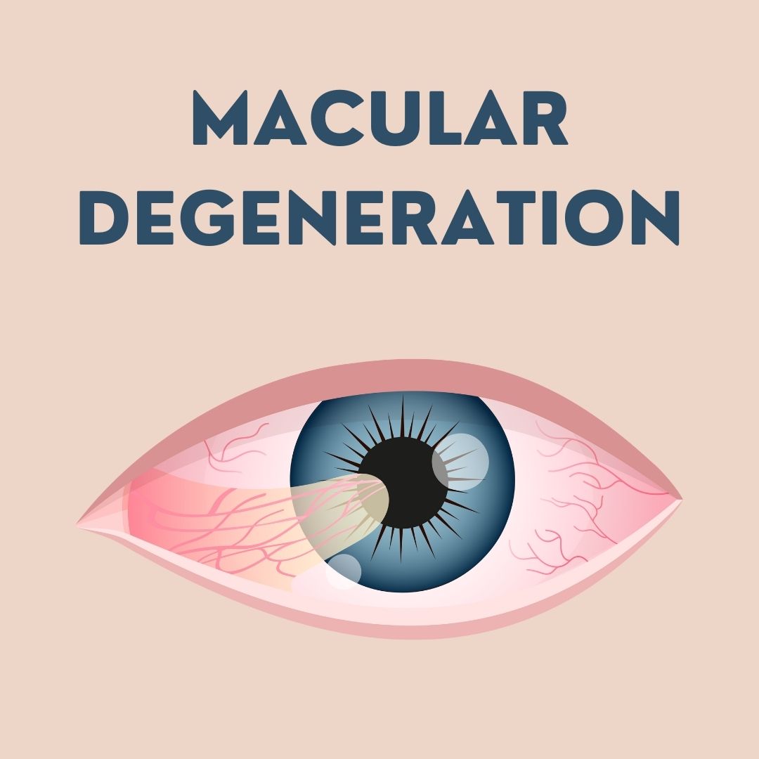 Macular Degeneration