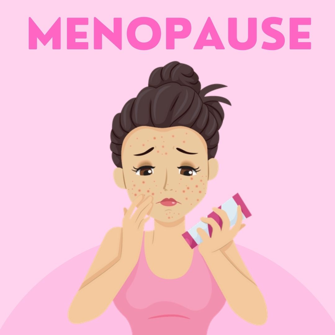 Menopause