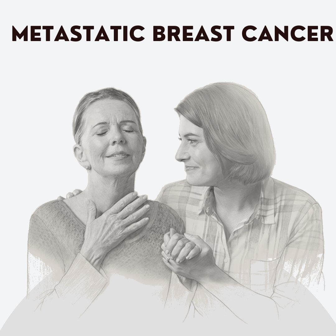 Metastatic Breast Cancer