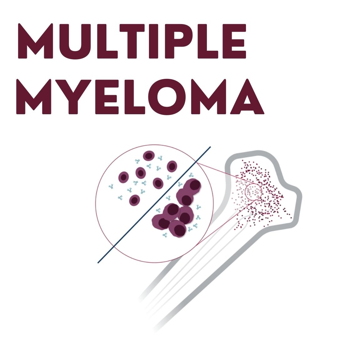 Multiple Myeloma