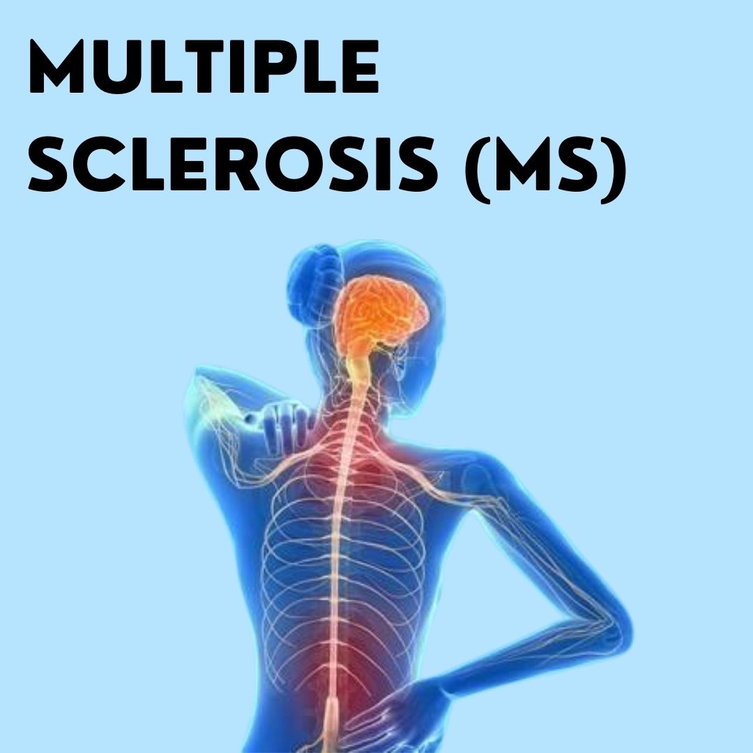 Multiple Sclerosis (MS)