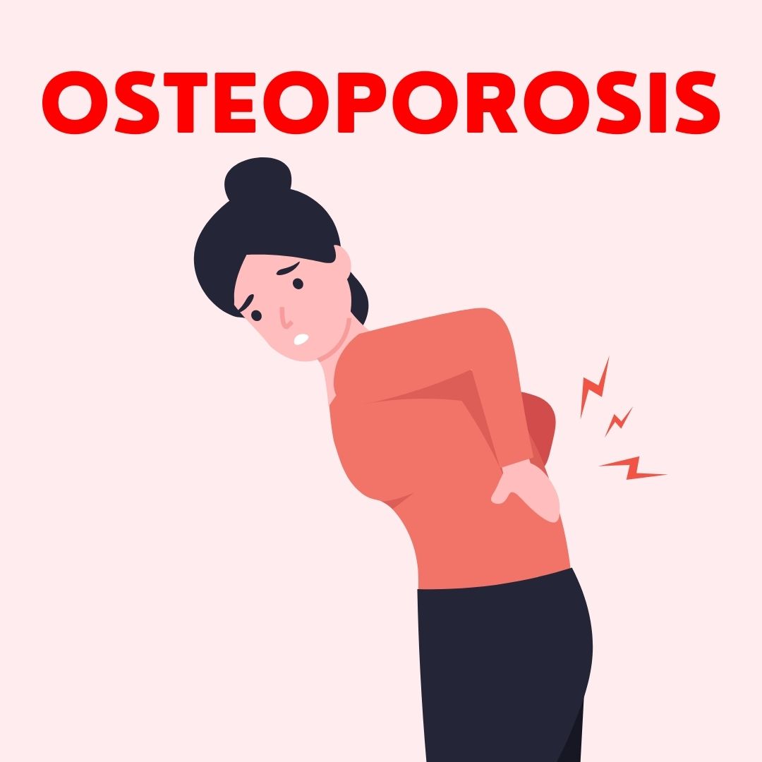 Osteoporosis