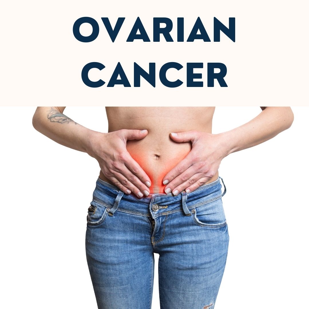 Ovarian Cancer