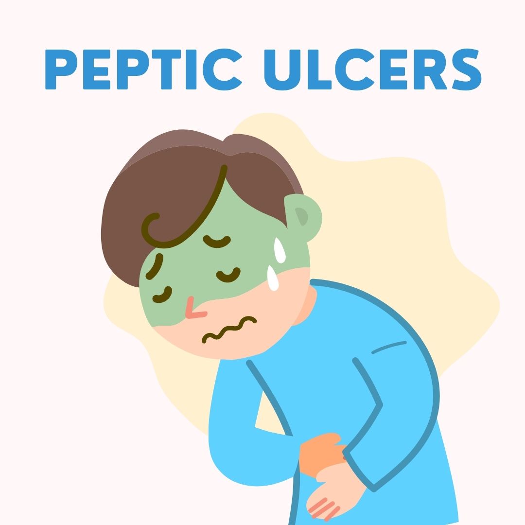 Peptic Ulcers