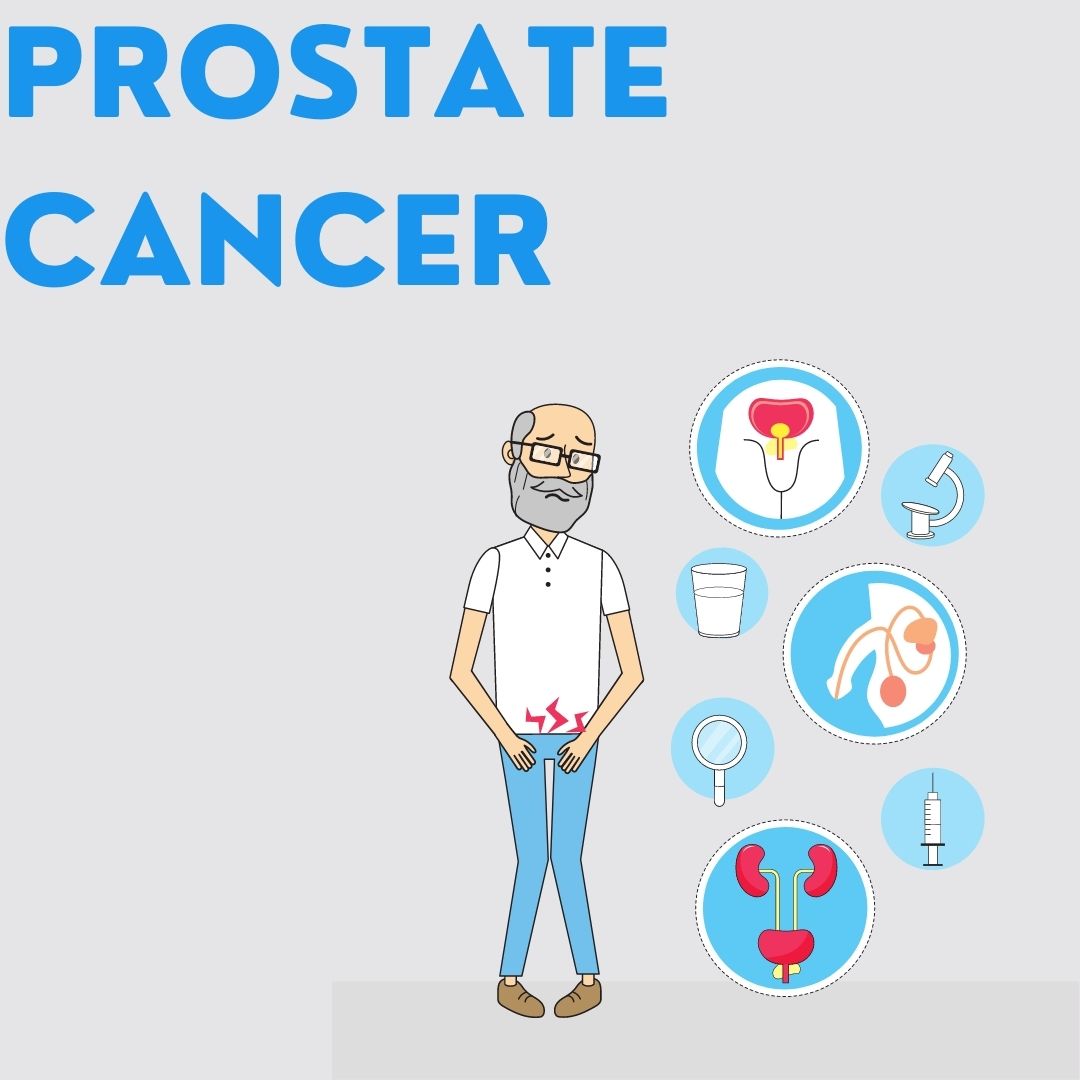 Prostate Cancer