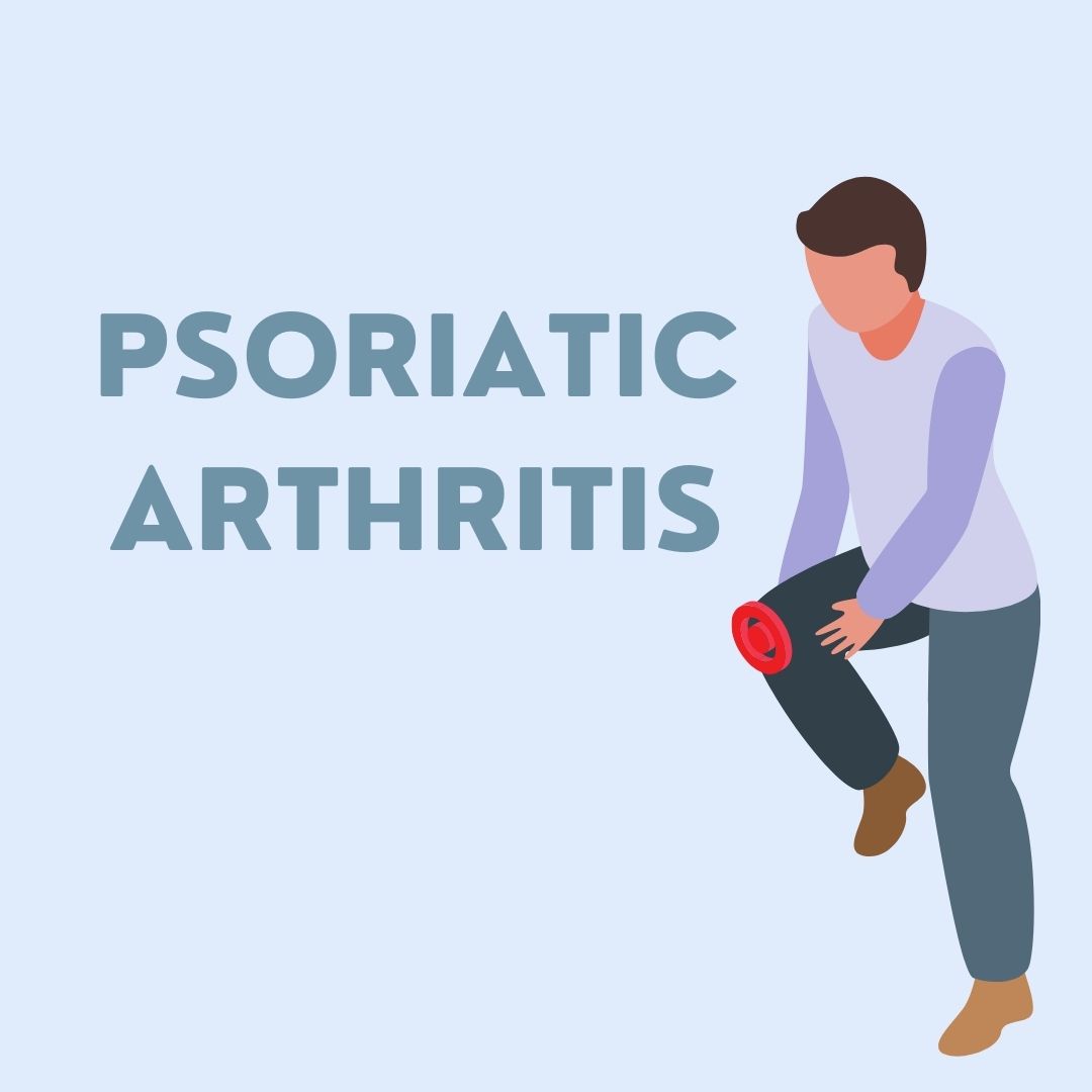 Psoriatic Arthritis