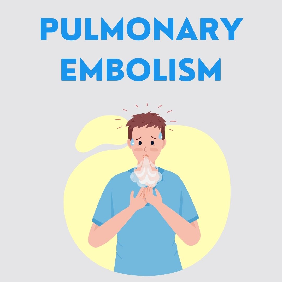 Pulmonary Embolism