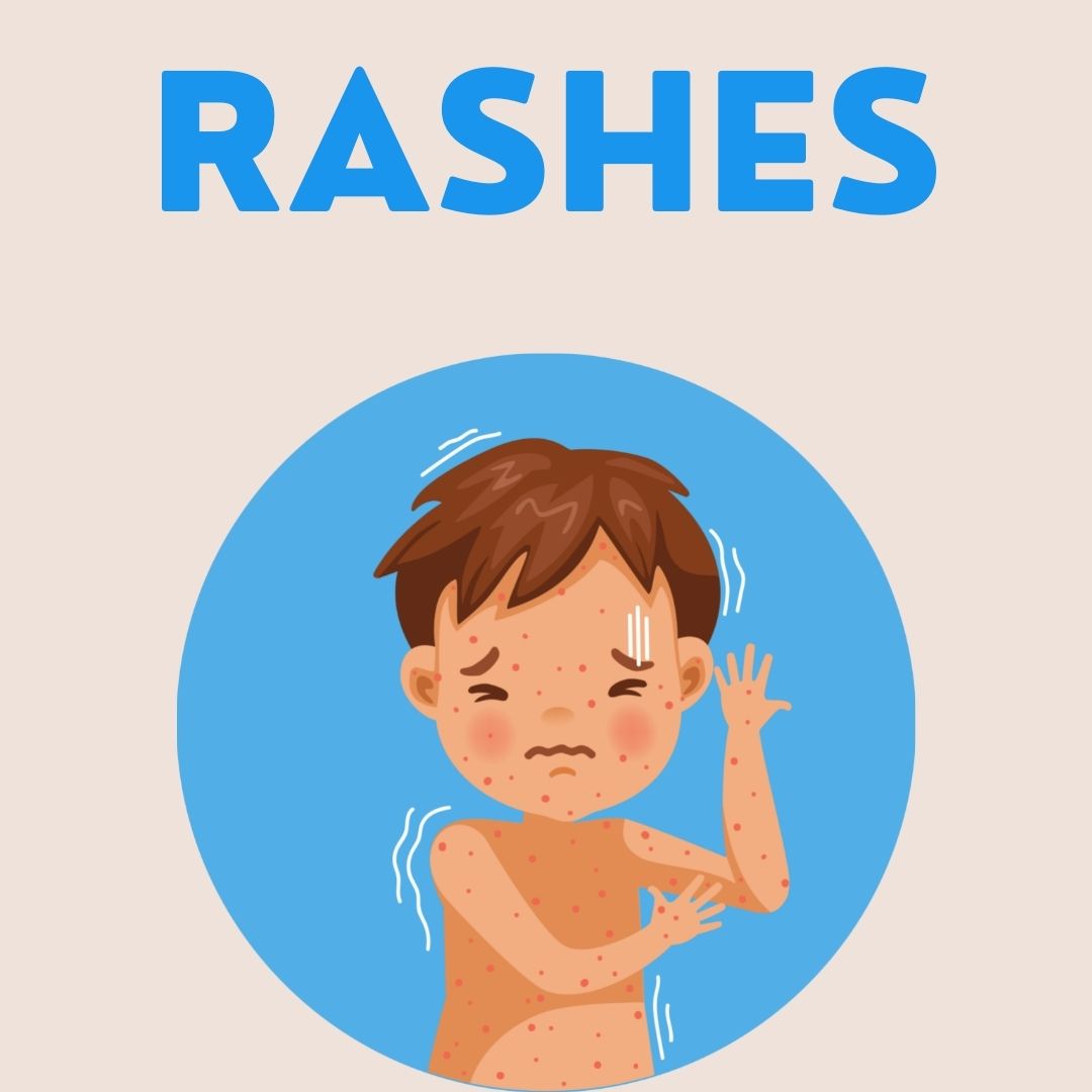 Rashes