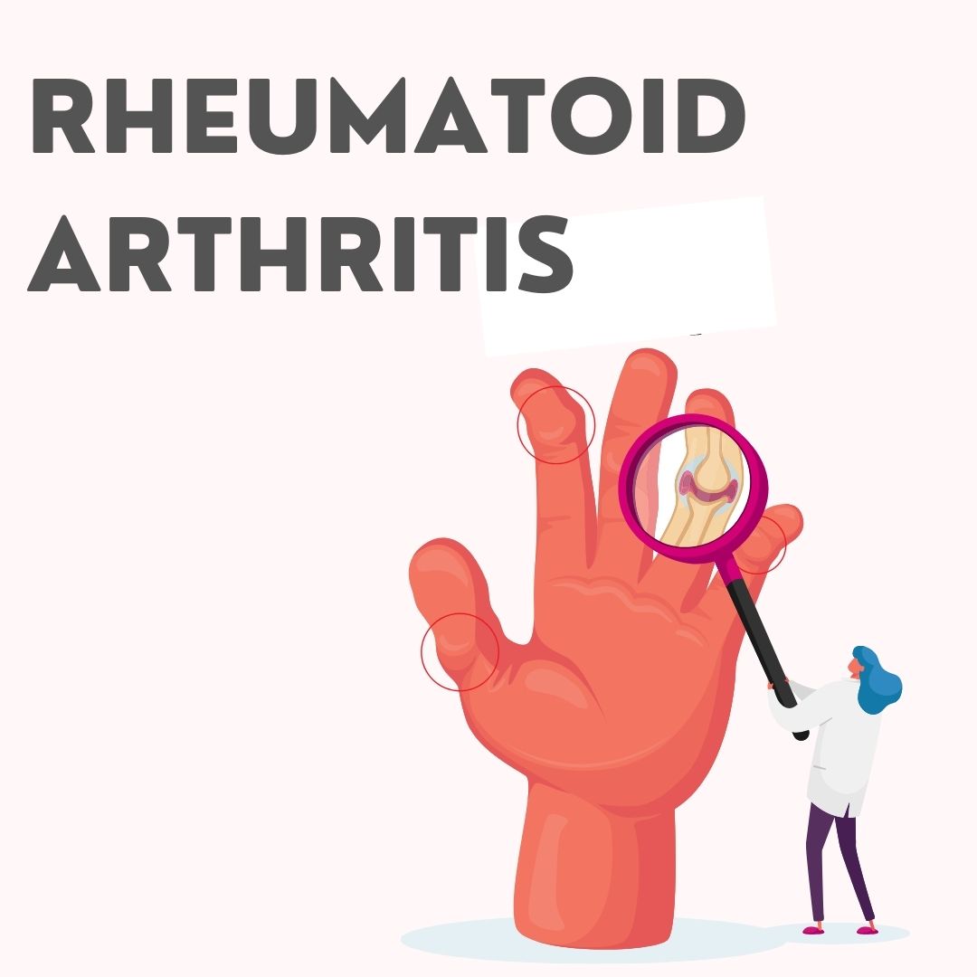 Rheumatoid Arthritis