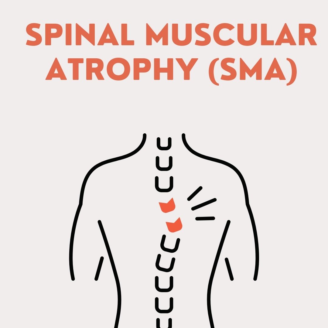 Spinal Muscular Atrophy (SMA)