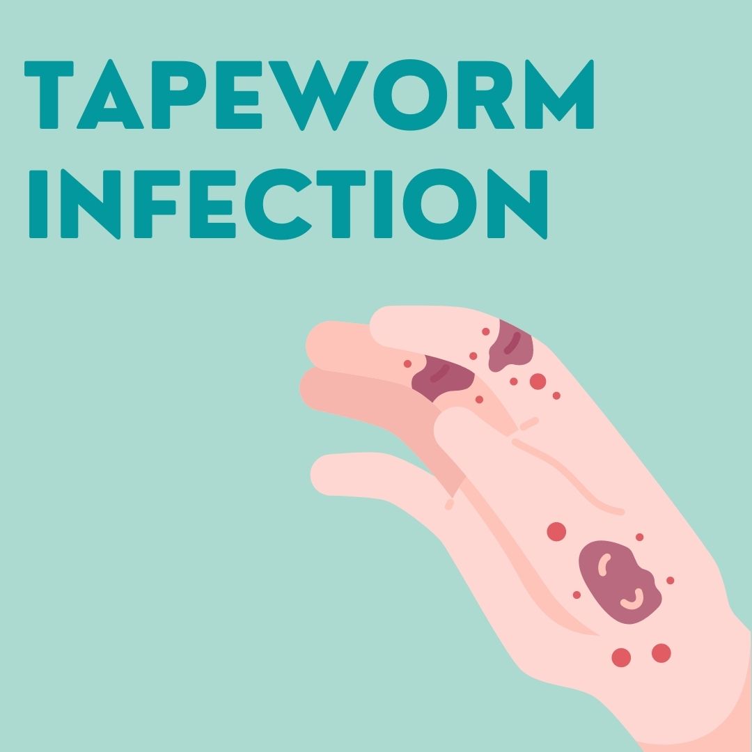 Tapeworm Infection