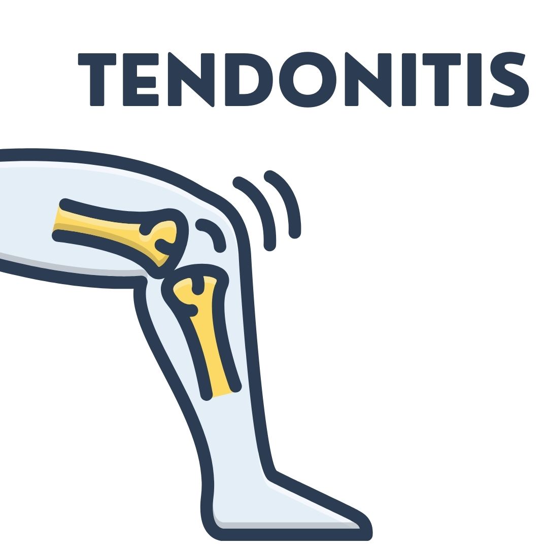 Tendonitis