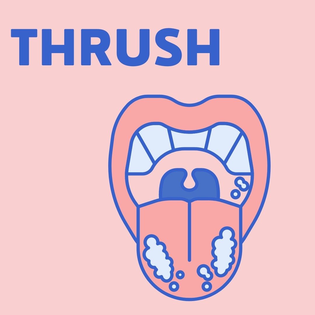 Thrush