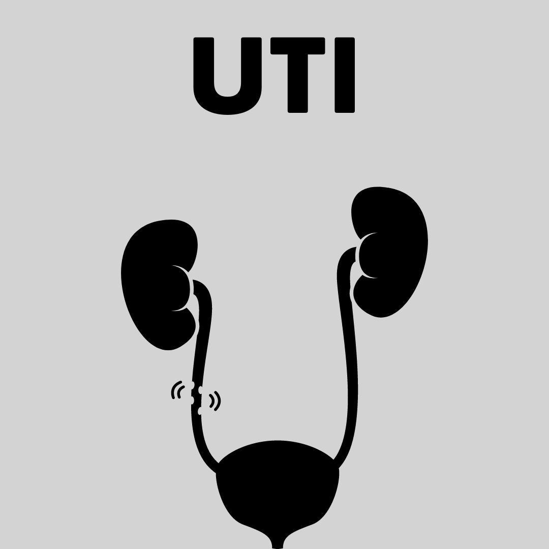 UTI