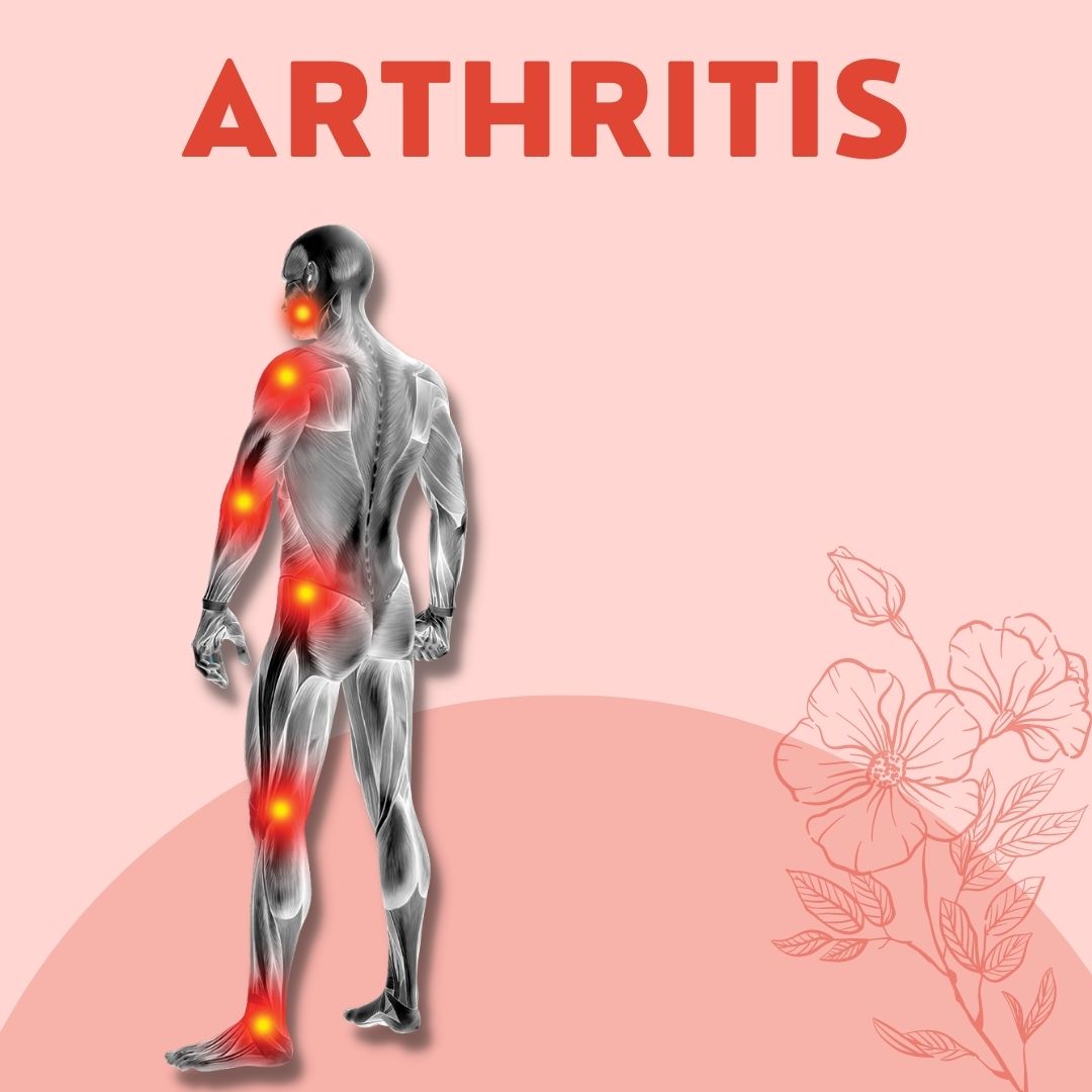 Arthritis