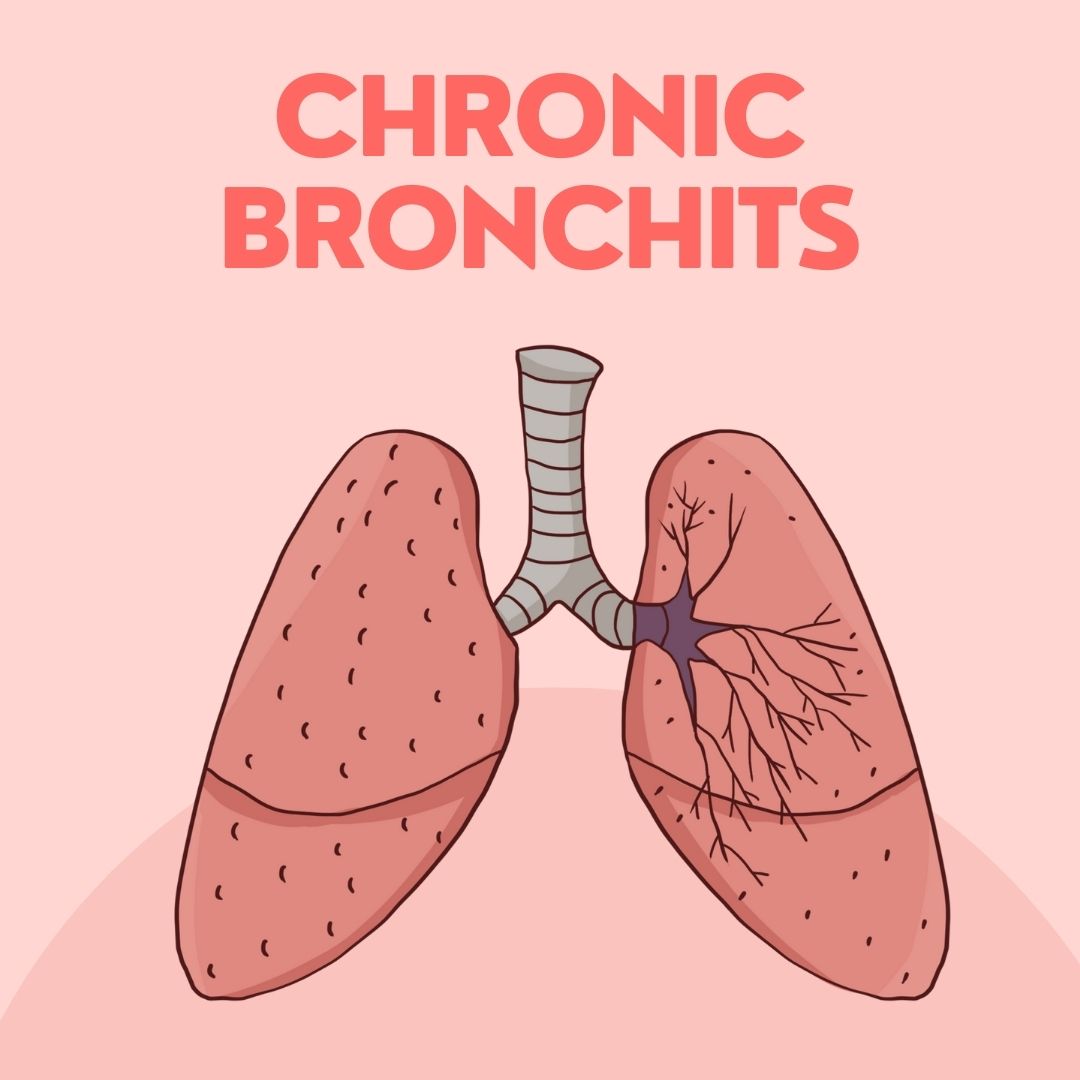Chronic bronchits